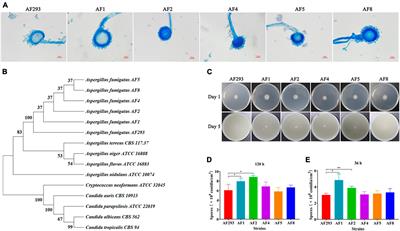 Comparative analysis of the biological characteristics and mechanisms of azole resistance of clinical Aspergillus fumigatus strains